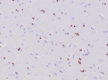 OLIG2 (Marker of Glial Brain Tumors) Antibody in Immunohistochemistry (Paraffin) (IHC (P))