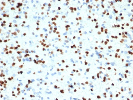 OLIG2 (Marker of Glial Brain Tumors) Antibody in Immunohistochemistry (Paraffin) (IHC (P))