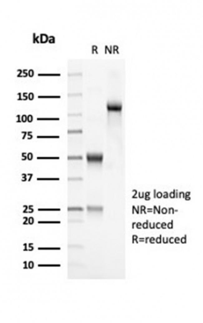 OLIG2 (Marker of Glial Brain Tumors) Antibody in Immunoelectrophoresis (IE)