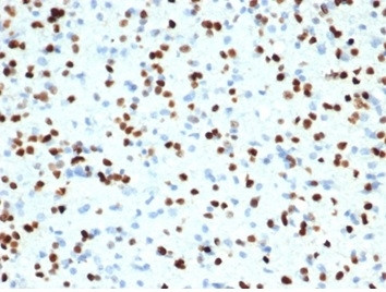 OLIG2 (Marker of Glial Brain Tumors) Antibody in Immunohistochemistry (Paraffin) (IHC (P))