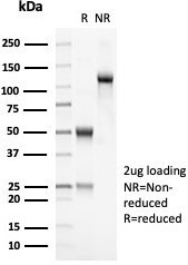 OLIG2 (Marker of Glial Brain Tumors) Antibody in SDS-PAGE (SDS-PAGE)