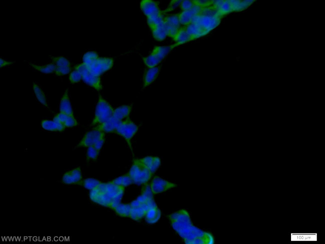 CDC37 Antibody in Immunocytochemistry (ICC/IF)