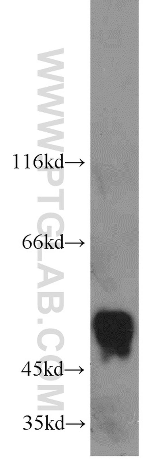 CDC37 Antibody in Western Blot (WB)