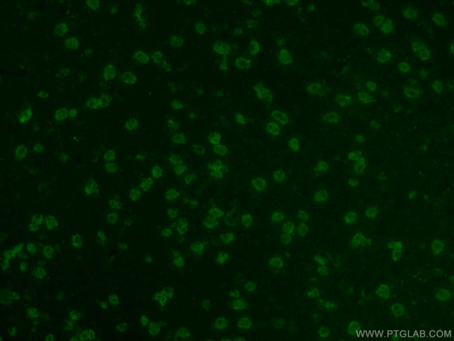 Sam68 Antibody in Immunohistochemistry (PFA fixed) (IHC (PFA))