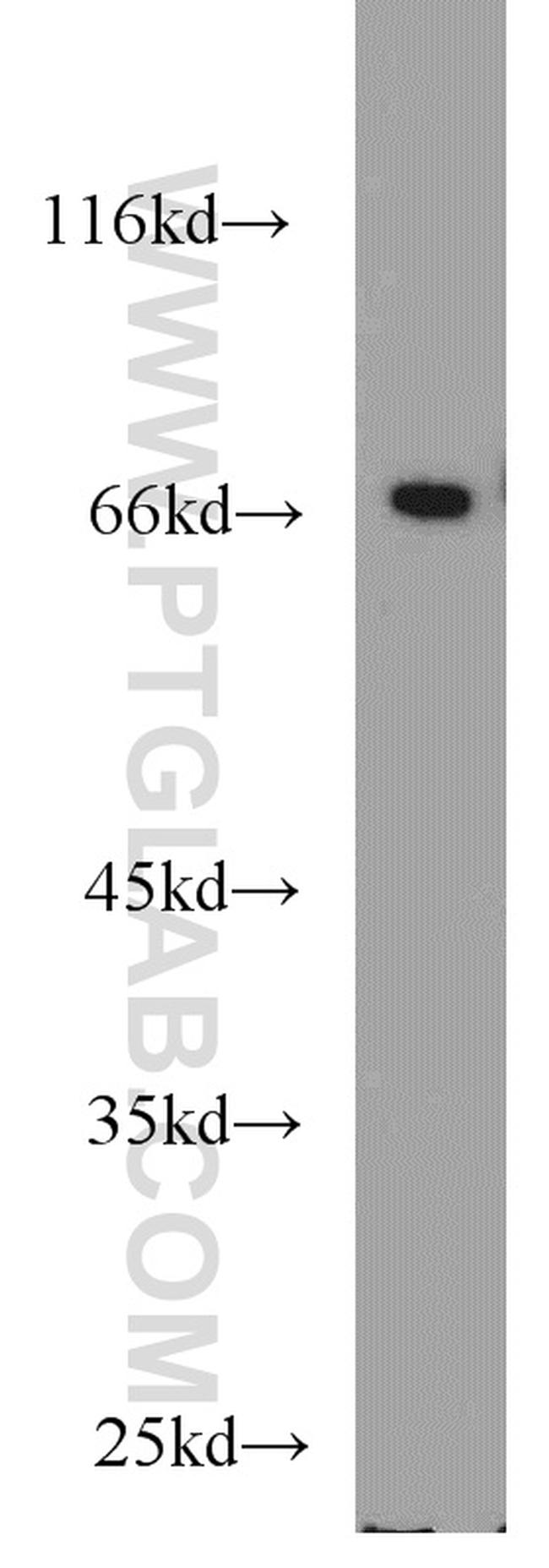 Sam68 Antibody in Western Blot (WB)