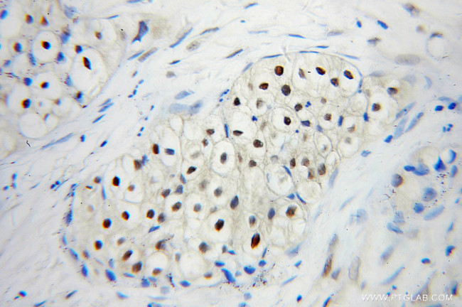 UBC9 Antibody in Immunohistochemistry (Paraffin) (IHC (P))