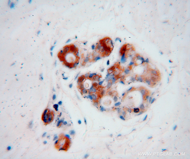 CRABP2 Antibody in Immunohistochemistry (Paraffin) (IHC (P))