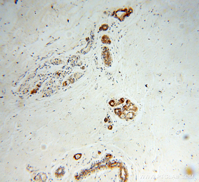 CRABP2 Antibody in Immunohistochemistry (Paraffin) (IHC (P))