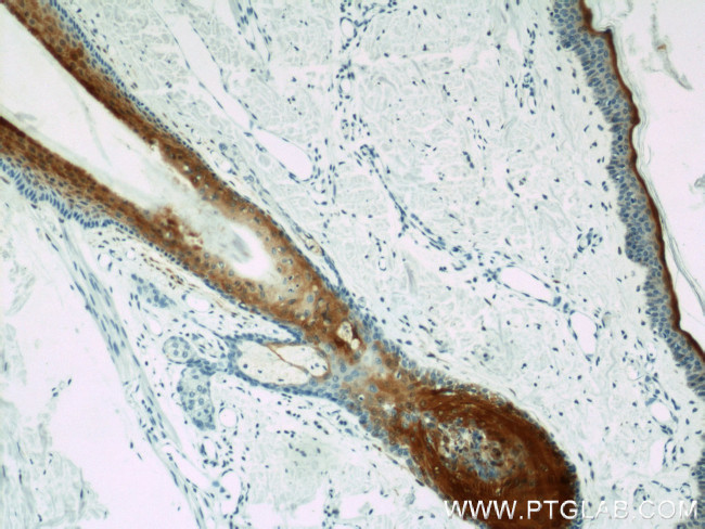 CRABP2 Antibody in Immunohistochemistry (Paraffin) (IHC (P))