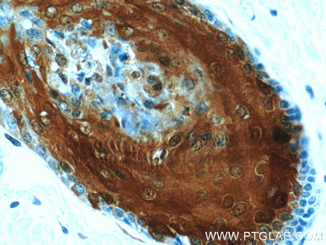 CRABP2 Antibody in Immunohistochemistry (Paraffin) (IHC (P))