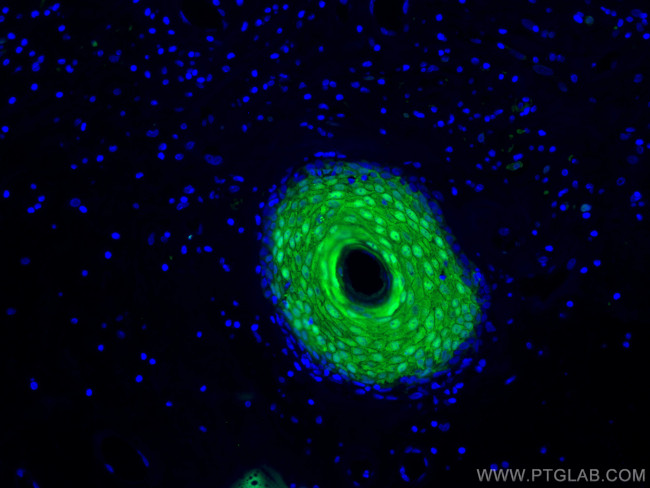 CRABP2 Antibody in Immunohistochemistry (PFA fixed) (IHC (PFA))