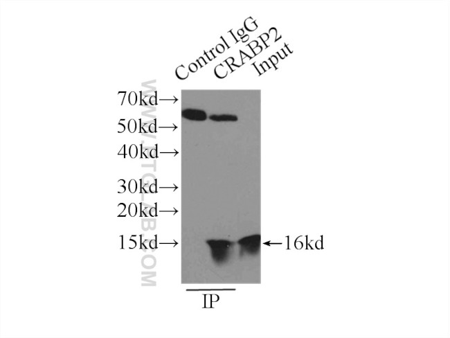 CRABP2 Antibody in Immunoprecipitation (IP)