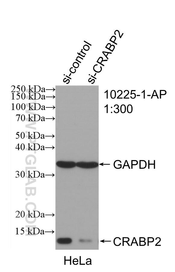 CRABP2 Antibody in Western Blot (WB)