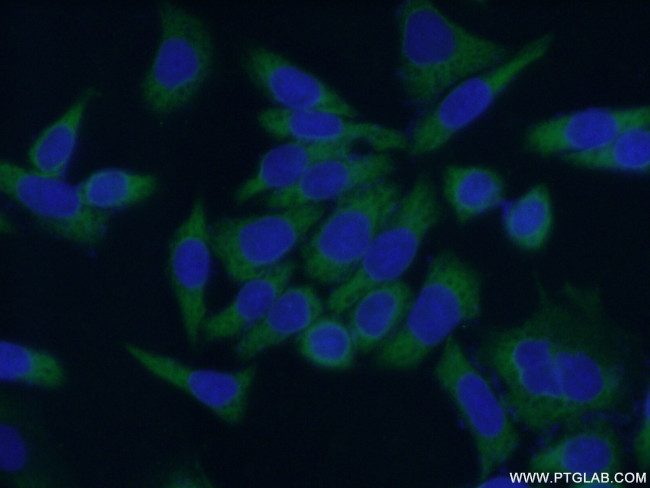 ABCF2 Antibody in Immunocytochemistry (ICC/IF)