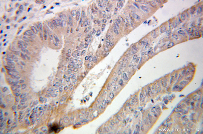 ABCF2 Antibody in Immunohistochemistry (Paraffin) (IHC (P))