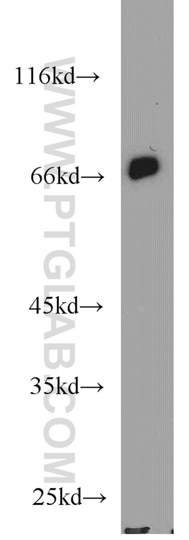 ABCF2 Antibody in Western Blot (WB)