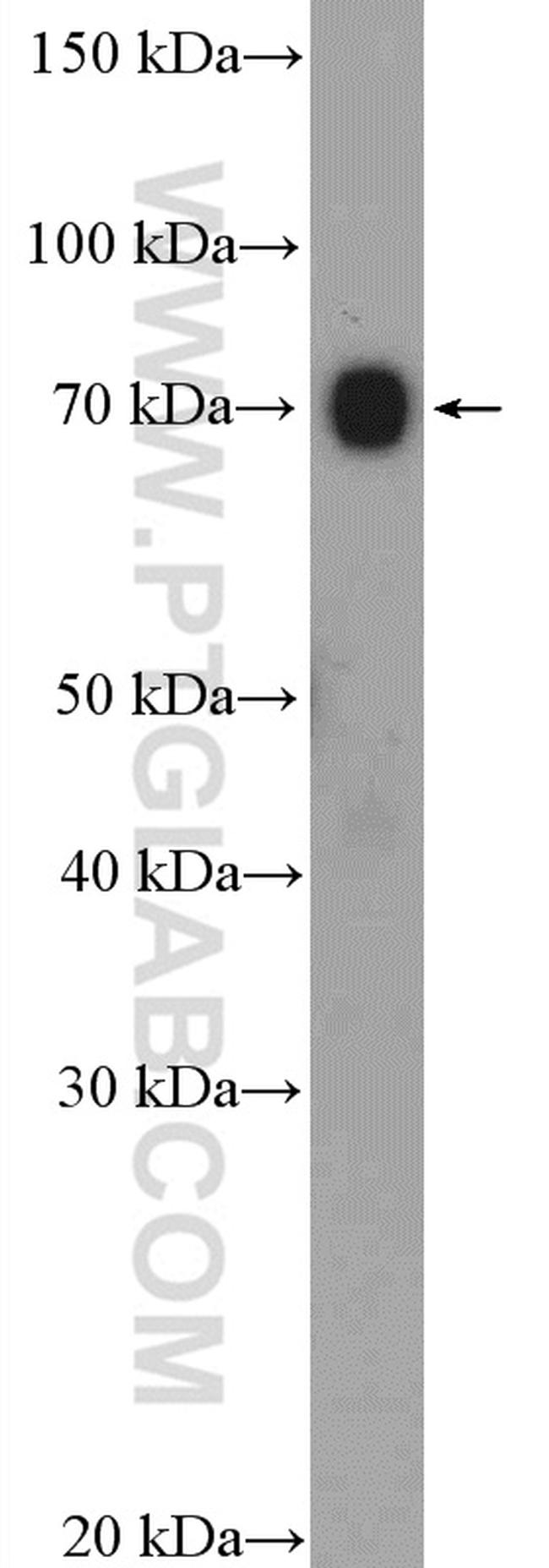 ABCF2 Antibody in Western Blot (WB)