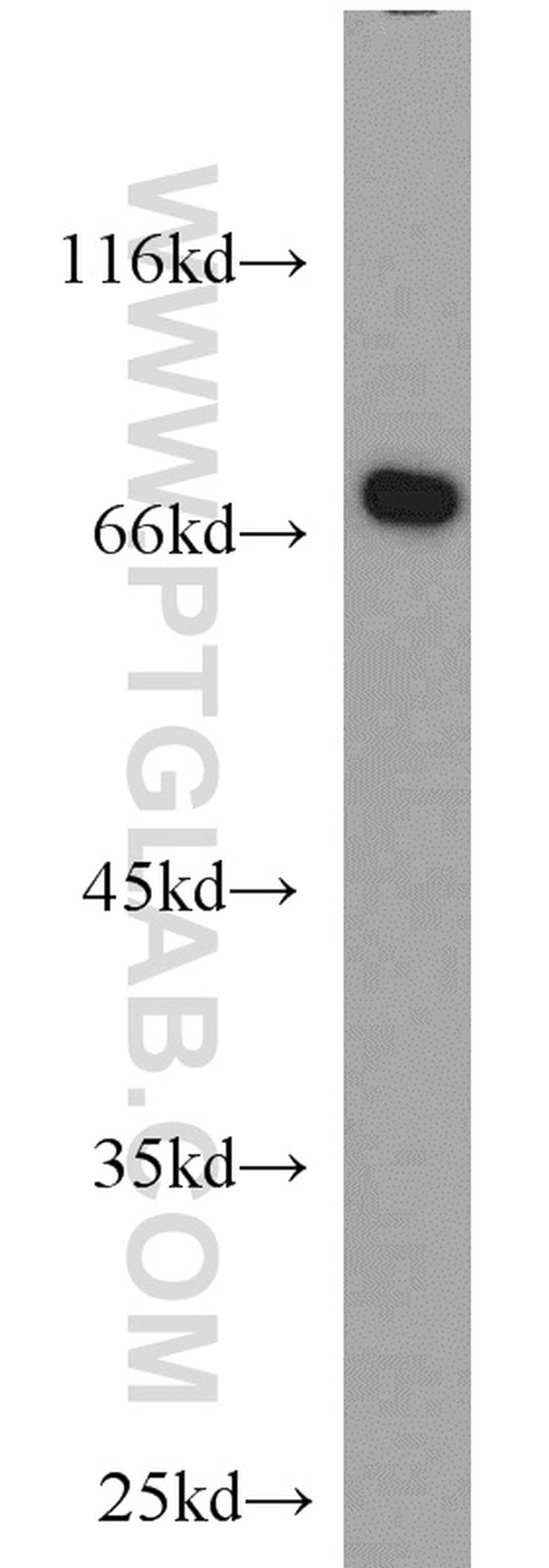 ABCF2 Antibody in Western Blot (WB)