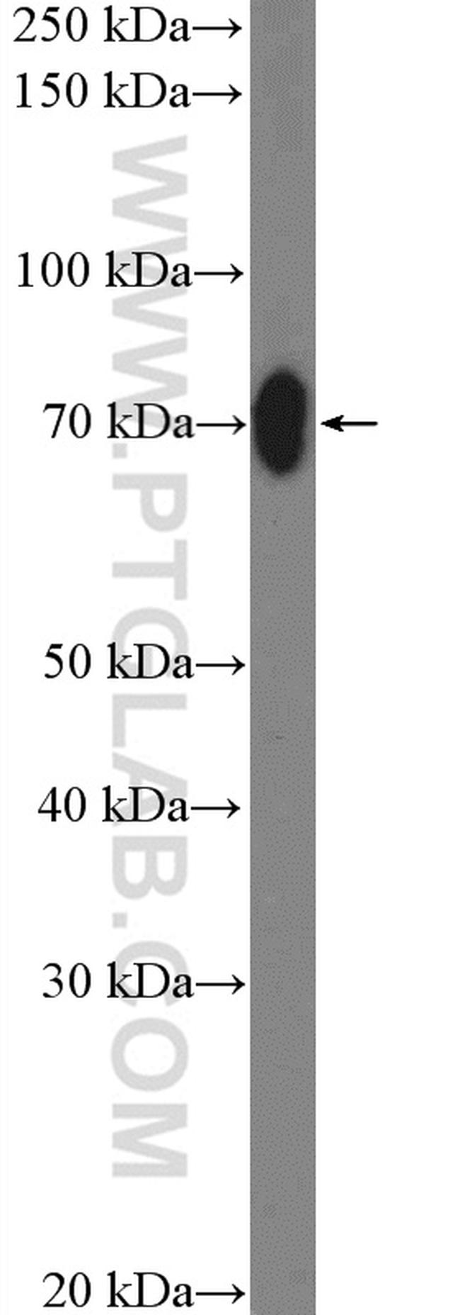 ABCF2 Antibody in Western Blot (WB)