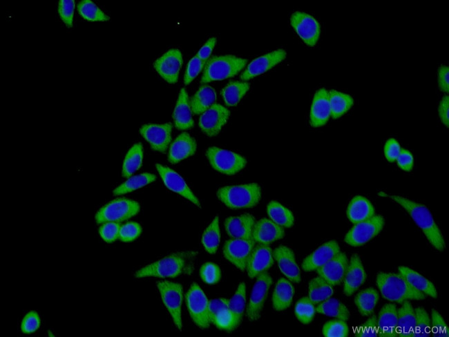 EIF2S2 Antibody in Immunocytochemistry (ICC/IF)