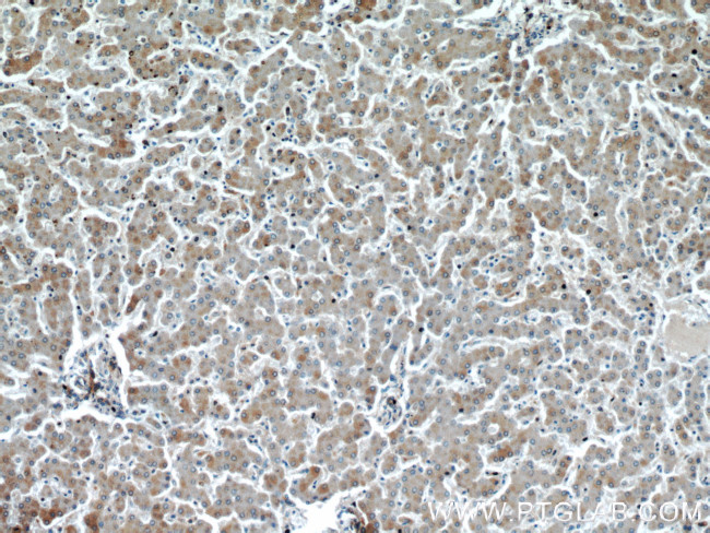 EIF2S2 Antibody in Immunohistochemistry (Paraffin) (IHC (P))