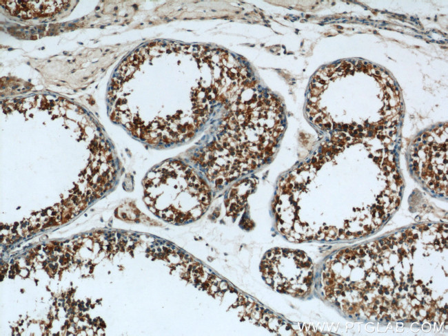 EIF2S2 Antibody in Immunohistochemistry (Paraffin) (IHC (P))