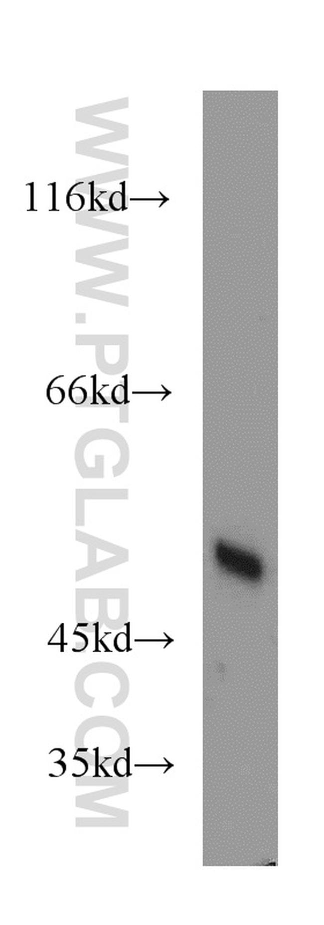 EIF2S2 Antibody in Western Blot (WB)