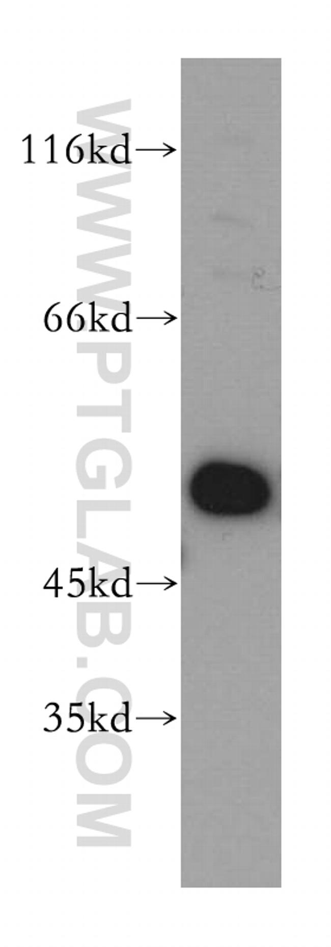 EIF2S2 Antibody in Western Blot (WB)