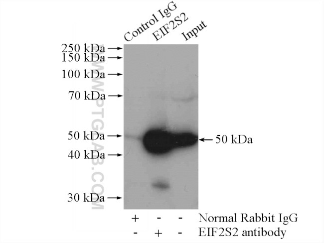 EIF2S2 Antibody in Immunoprecipitation (IP)