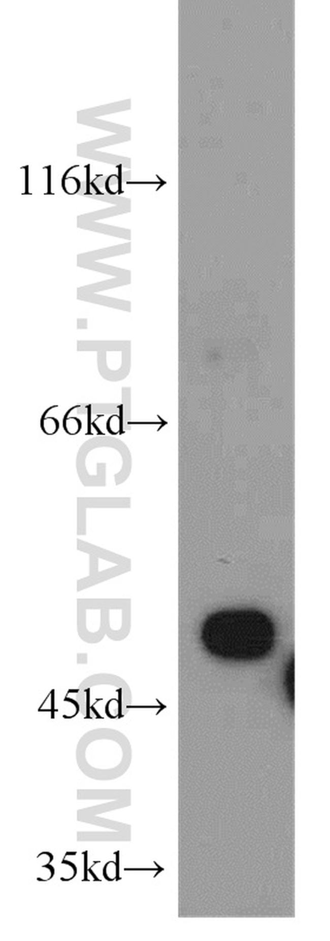 EIF2S2 Antibody in Western Blot (WB)