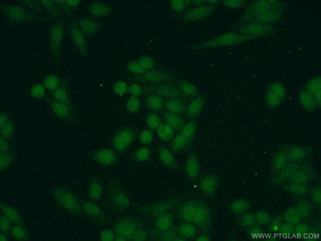 SAE1 Antibody in Immunocytochemistry (ICC/IF)