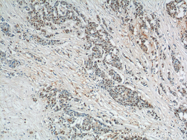 SAE1 Antibody in Immunohistochemistry (Paraffin) (IHC (P))