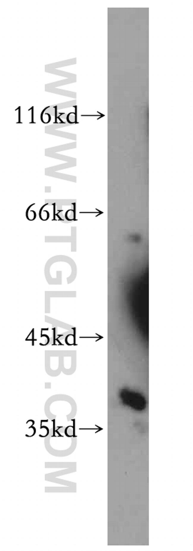 SAE1 Antibody in Western Blot (WB)