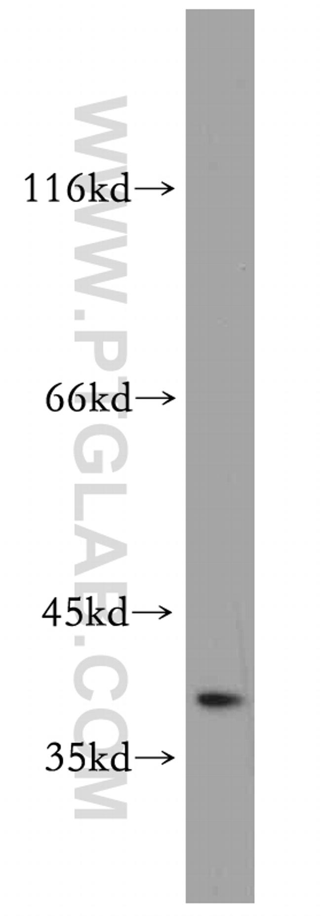 SAE1 Antibody in Western Blot (WB)