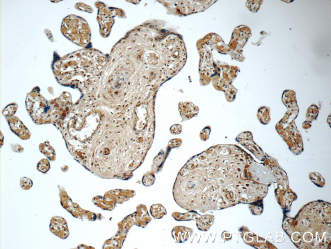 SMAD4 Antibody in Immunohistochemistry (Paraffin) (IHC (P))