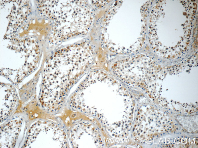 SMAD4 Antibody in Immunohistochemistry (Paraffin) (IHC (P))