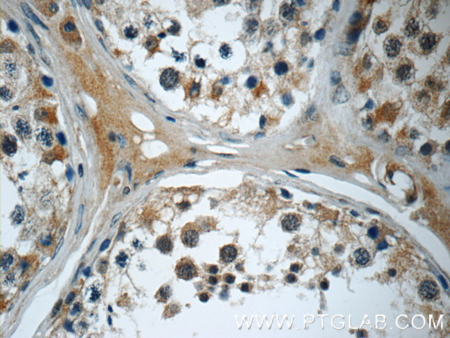 SMAD4 Antibody in Immunohistochemistry (Paraffin) (IHC (P))