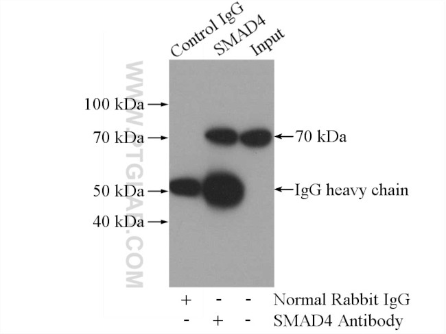 SMAD4 Antibody in Immunoprecipitation (IP)