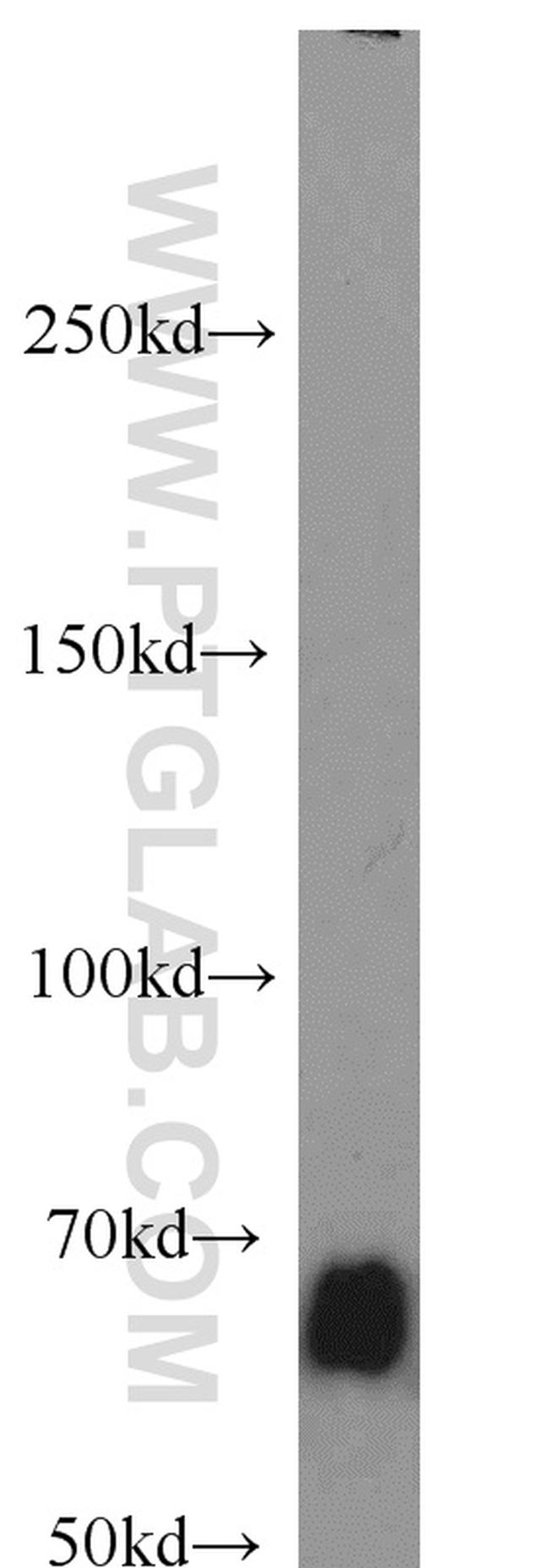 SMAD4 Antibody in Western Blot (WB)