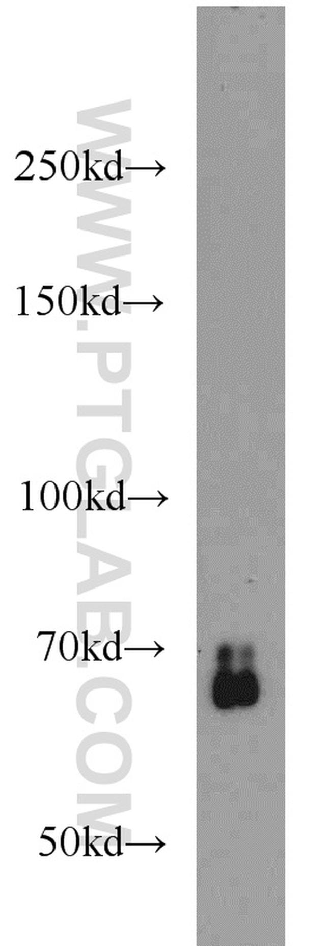 SMAD4 Antibody in Western Blot (WB)