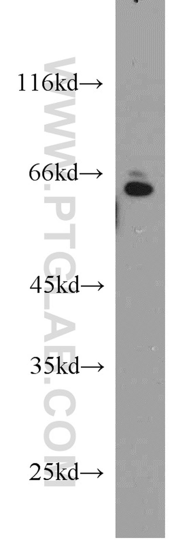 SMAD4 Antibody in Western Blot (WB)