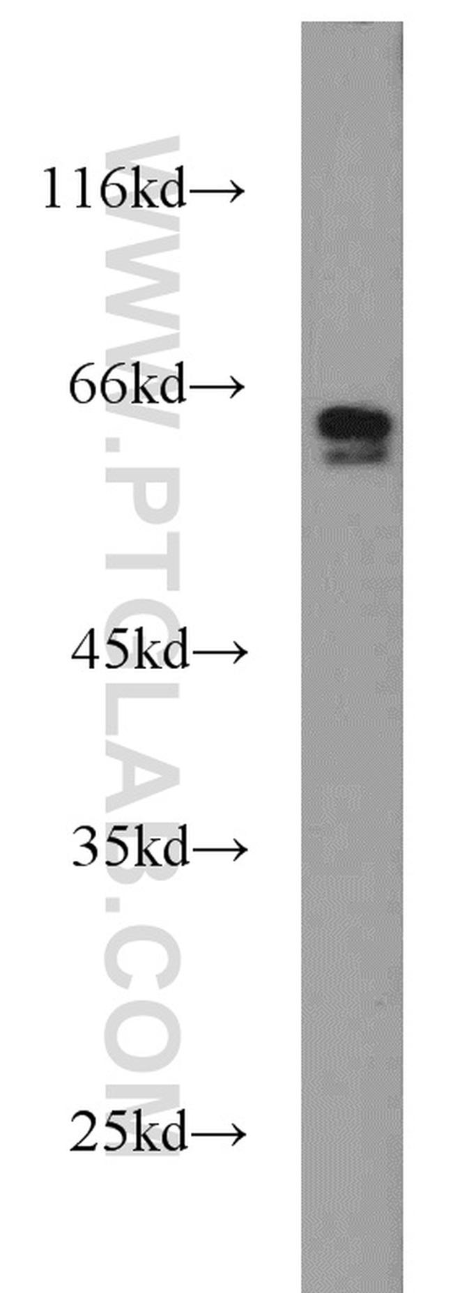 SMAD4 Antibody in Western Blot (WB)