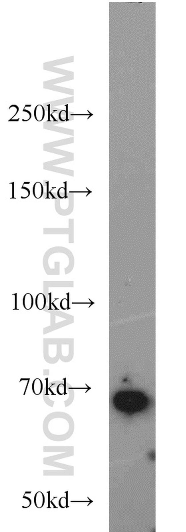 SMAD4 Antibody in Western Blot (WB)