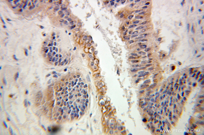 ARL2 Antibody in Immunohistochemistry (Paraffin) (IHC (P))