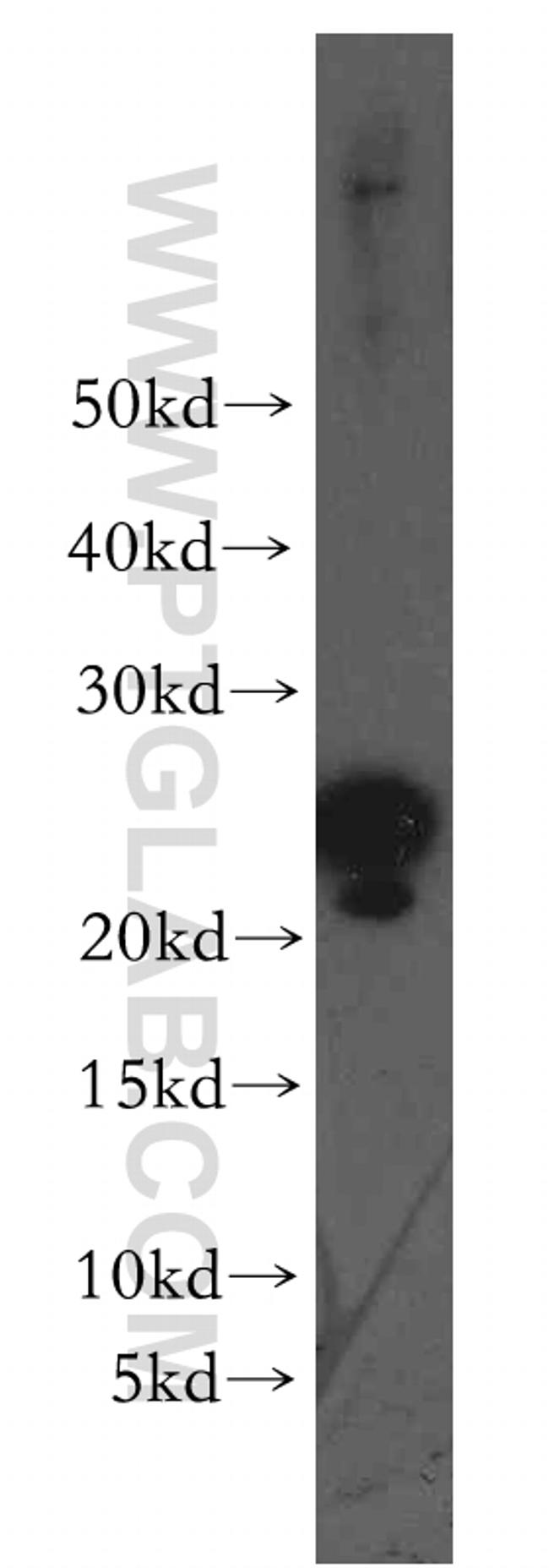 ARL2 Antibody in Western Blot (WB)