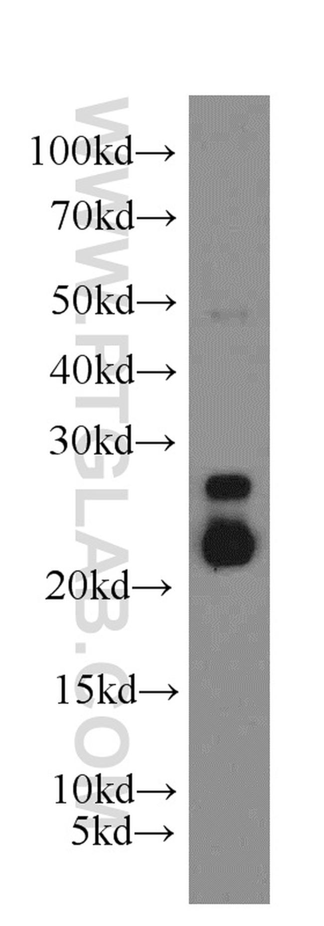 ARL2 Antibody in Western Blot (WB)