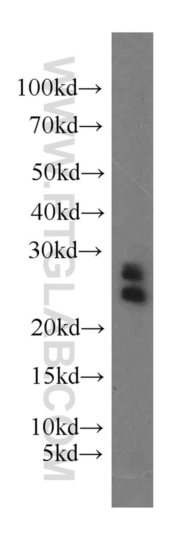 ARL2 Antibody in Western Blot (WB)