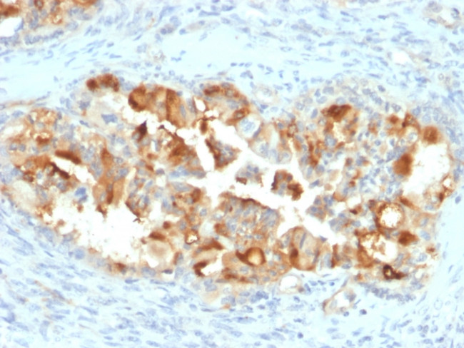 Mesothelin Antibody in Immunohistochemistry (Paraffin) (IHC (P))