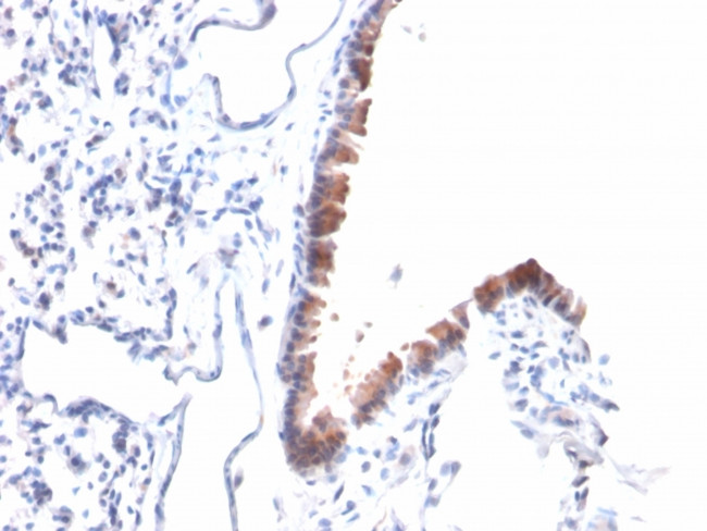 Mesothelin Antibody in Immunohistochemistry (Paraffin) (IHC (P))