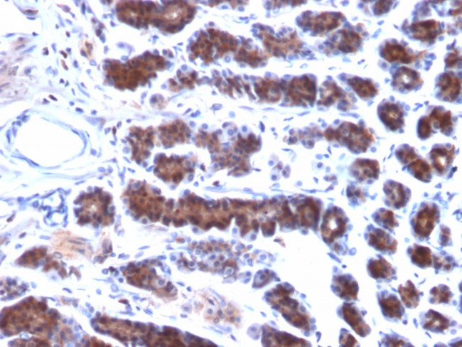 Mesothelin Antibody in Immunohistochemistry (Paraffin) (IHC (P))